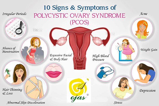 PCOS Treatment in Pune