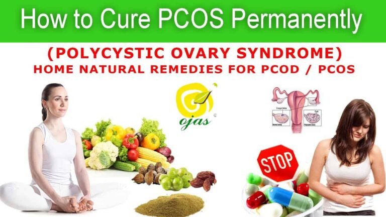 How to Cure PCOS Permanently